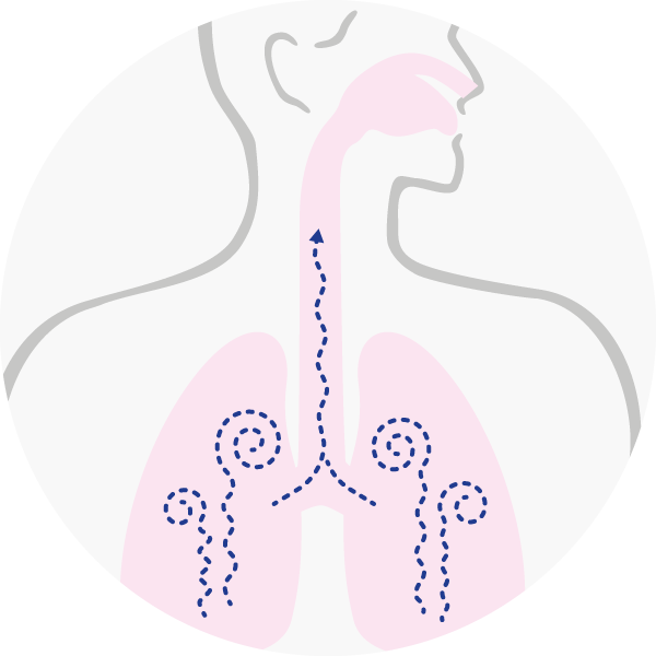 12 Aerosol - Basse vie respiratorie