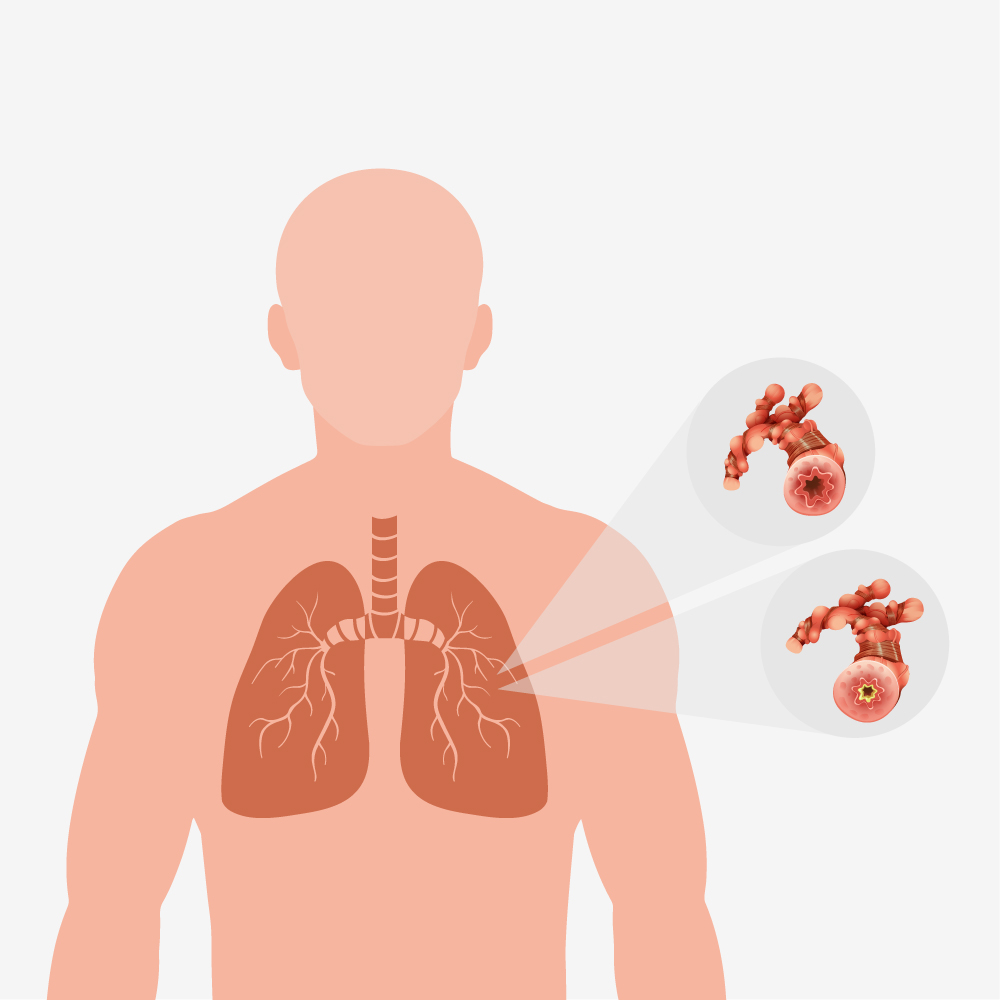 le-vie-respiratorie Flaem: Dispositivi Elettromedicali